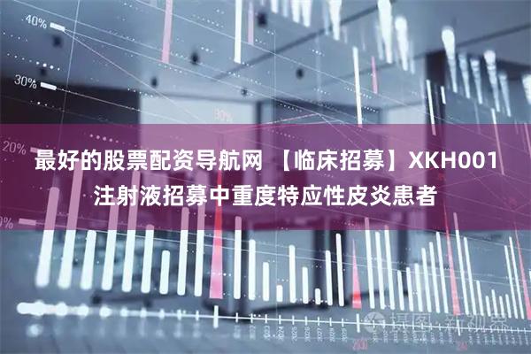 最好的股票配资导航网 【临床招募】XKH001注射液招募中重度特应性皮炎患者